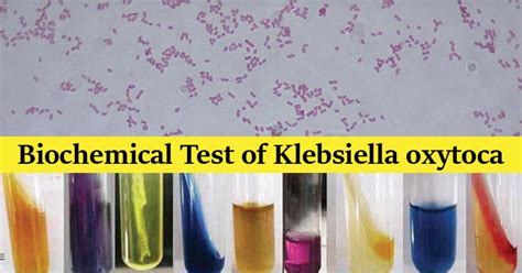 klebsiella oxytoca oxidase test.